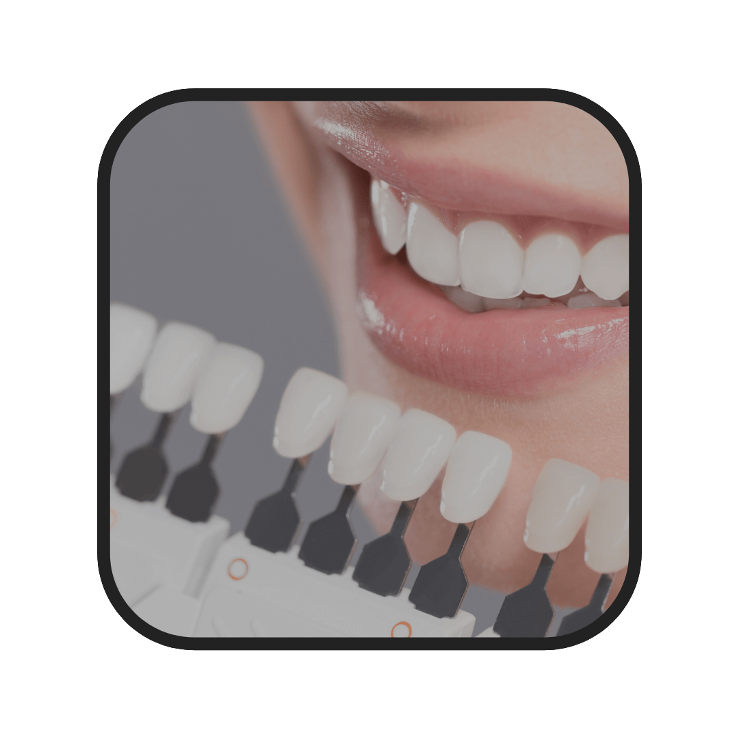 blanqueamiento dental