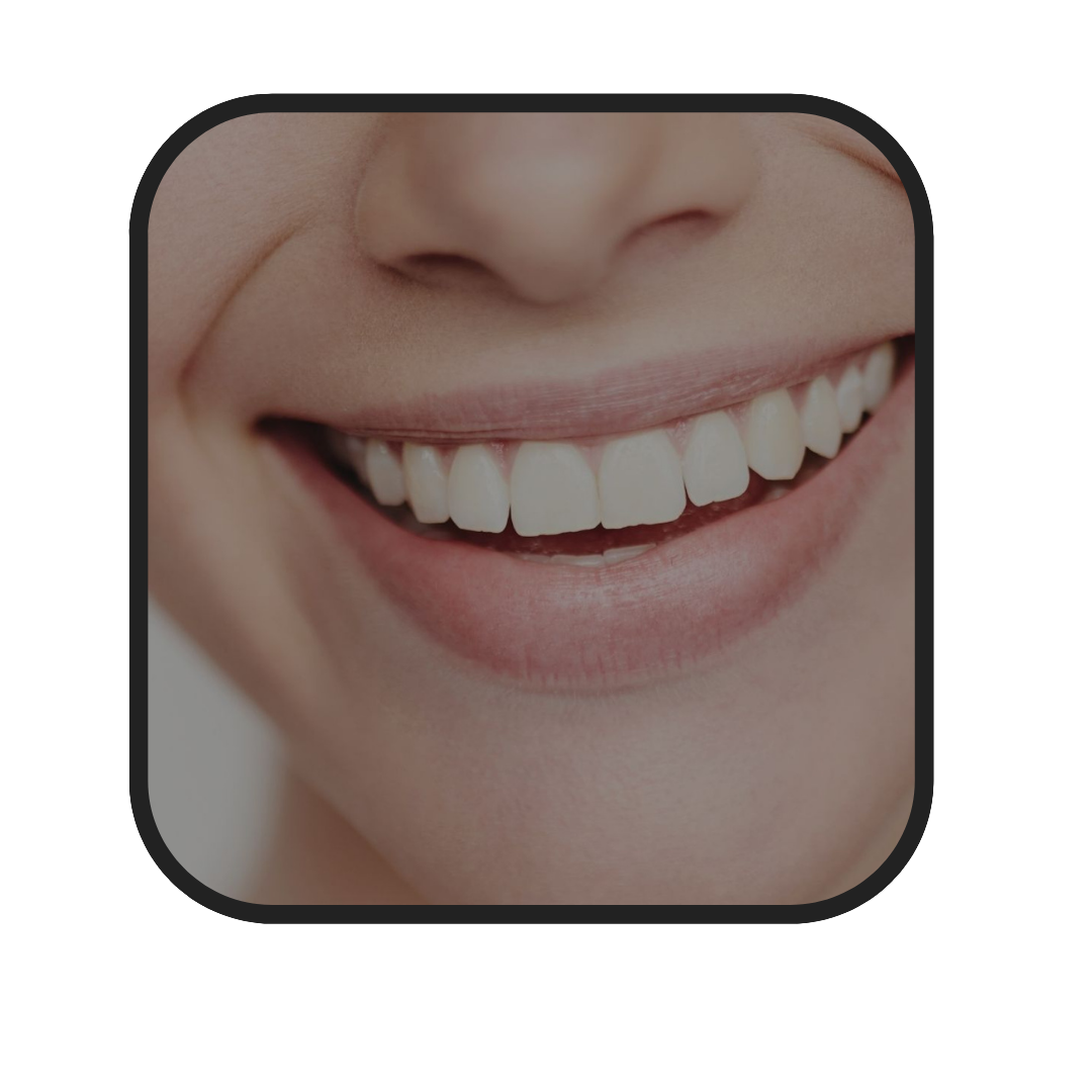 fundas dentales