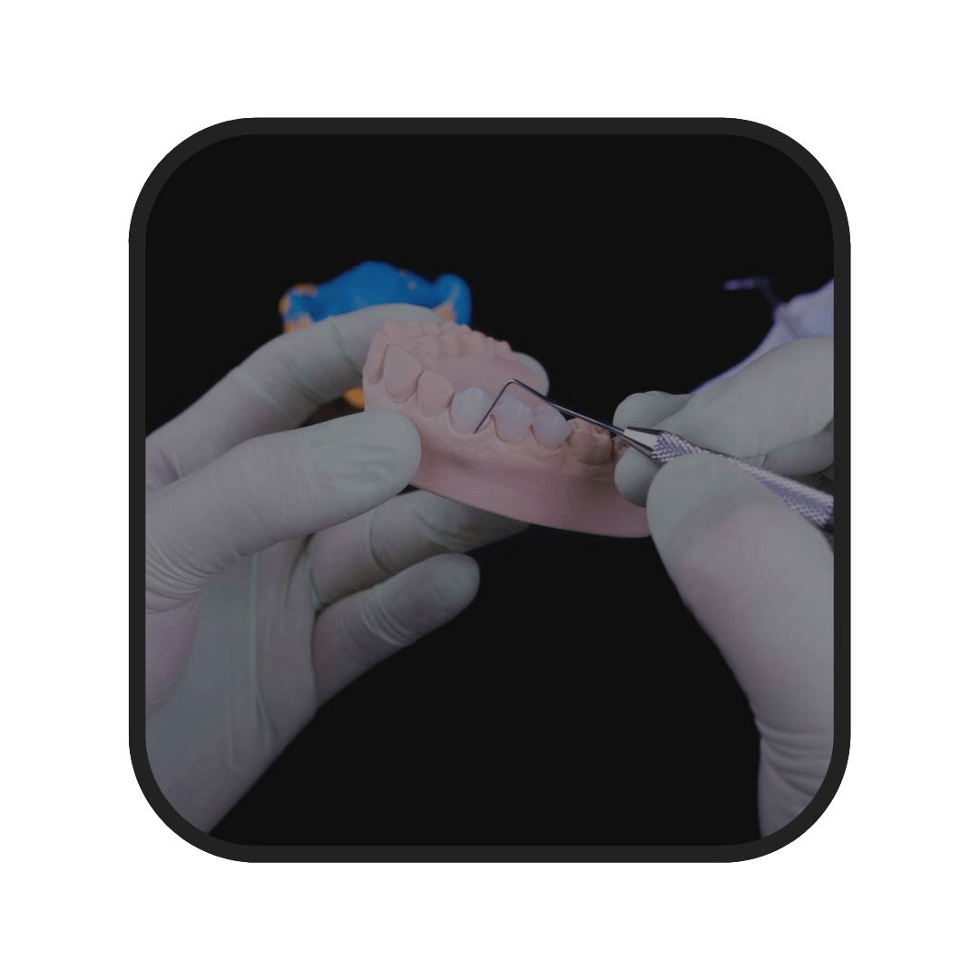 protesis dentales en alcoy
