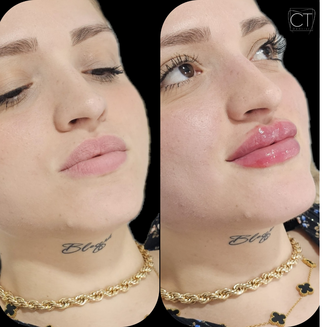 russianlips