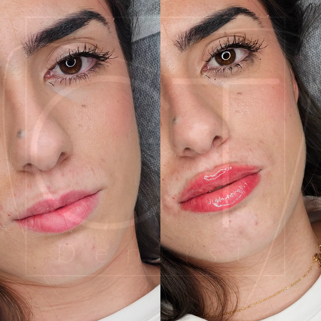 russianlips4