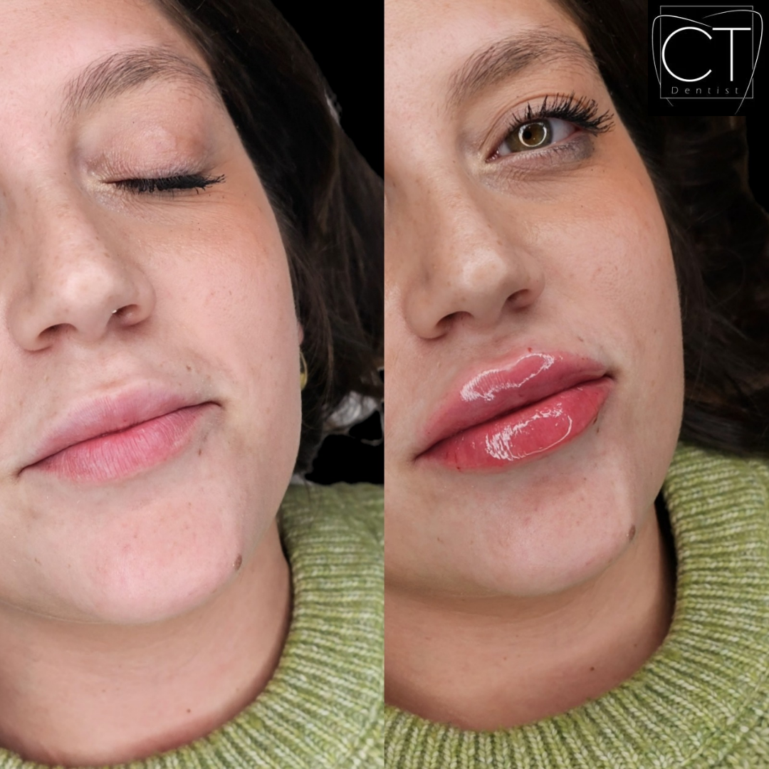 russianlips3